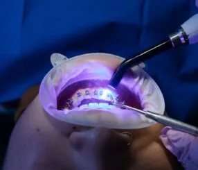 Descubra os Melhores Dentistas Especializados em São Paulo Descubra os Melhores Dentistas Especializados em São Paulo